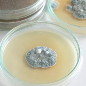 La scoperta della penicillina: l’errore che ha cambiato la storia della medicina.