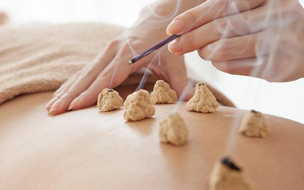 Moxibustione: il calore dell’artemisia nella medicina tradizionale cinese.